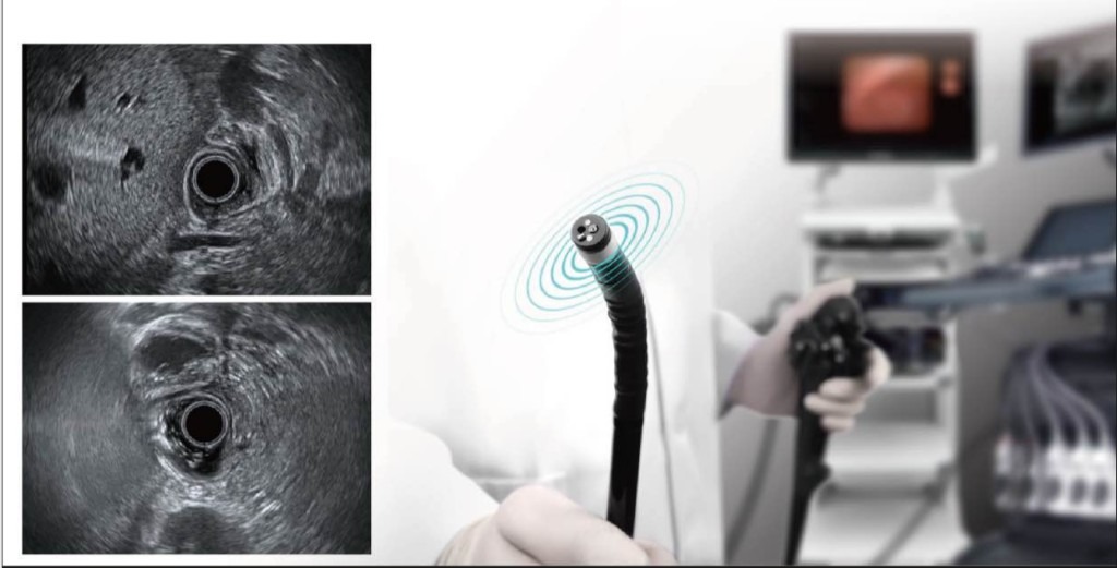 Medical Endoscopy